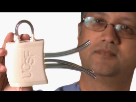 কিডনির সমস্যা দূর করতে আসছে 'কৃত্তিম-কিডনি', এর বাঙালী যোগ কি জানেন ?