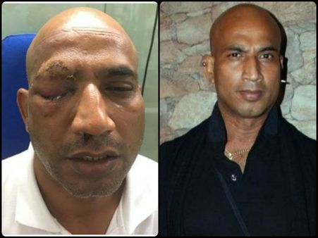 রাজস্থানে দুষ্কৃতীদের হাতে আক্রান্ত অভিনেতা জিতু বর্মা, চির জীবনের মতো নষ্ট হতে পারে চোখ