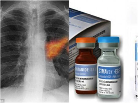 এই দেশে ফুসফুসের ক্যানসারের প্রতিষেধক আবিষ্কার, তালিকায় আর কী কী, বিস্তারিত জেনে নিন