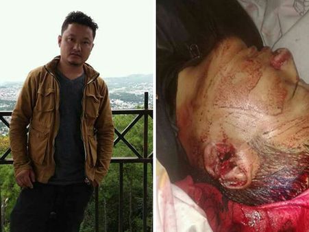 পাহাড়ের হিংসায় আরও এক মৃত্যু, ফের কাঠগড়ায় পুলিশ