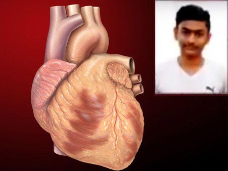 ১১৭ মিনিটে ১১৫৮ কি.মি পথ পাড়ি দিল হৃদপিন্ড, বাঁচল জীবন,এক অসামান্য কাহিনি