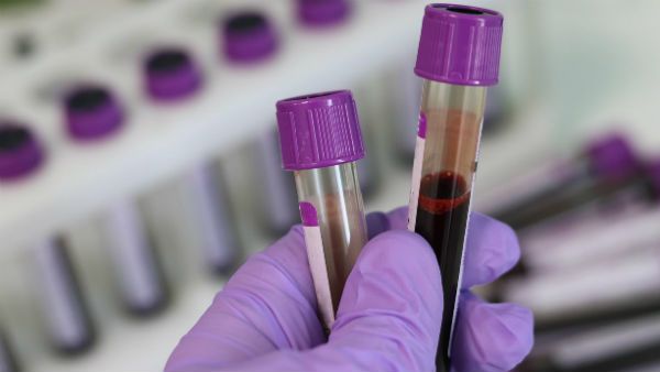 কোন রক্তের গ্রুপের করোনা আক্রান্তদের শ্বাসকষ্টের সমস্যা বেশি ? জেনে নিন কি বলছে গবেষণা