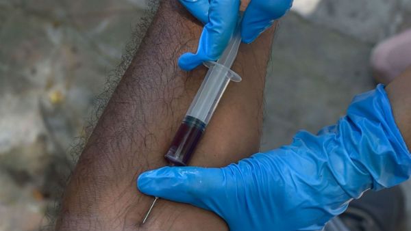 কন্যা সন্তানের বাবা হওয়ার খুশিতে বিনামূল্যে রক্ত পরীক্ষা বালুরঘাটে