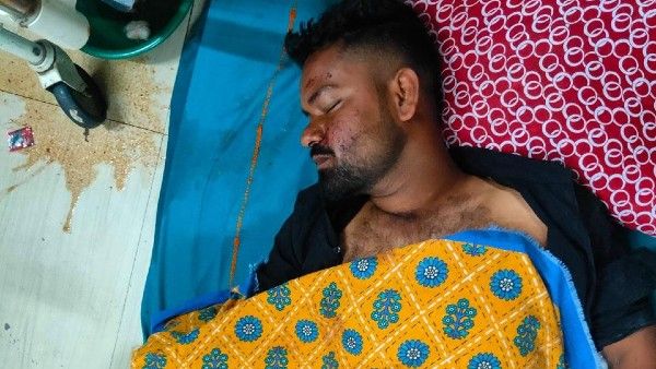 দুর্ঘটনায় ছিন্ন হাত ওয়ার্ড থেকে গেল কুকুরের মুখে! চরম গাফিলতির অভিযোগ উত্তরবঙ্গ মেডিক্যালের বিরুদ্ধে