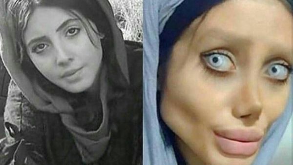 প্ল্যাস্টিক সার্জারি নয় এডিট করা হয়েছিল ‘জোম্বি অ্যাঞ্জেলিনা’র ছবি, প্রকাশ্যে এল আসল চেহারা