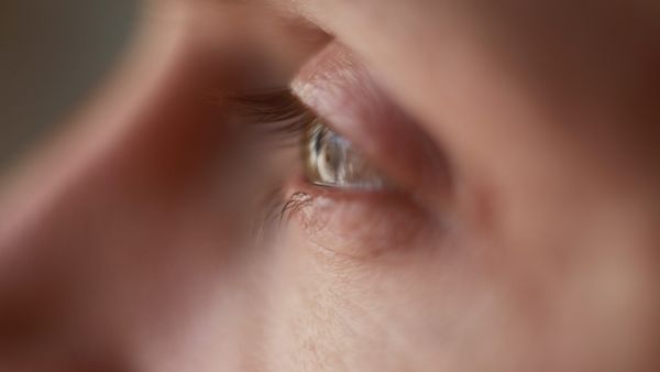 Conjunctivitis Cases Surge: রক্ত লাল হয়ে উঠছে চোখ, কীভাবে বাঁচবেন সংক্রমণ থেকে জেনে নিন চিকিৎসকের পরামর্শ