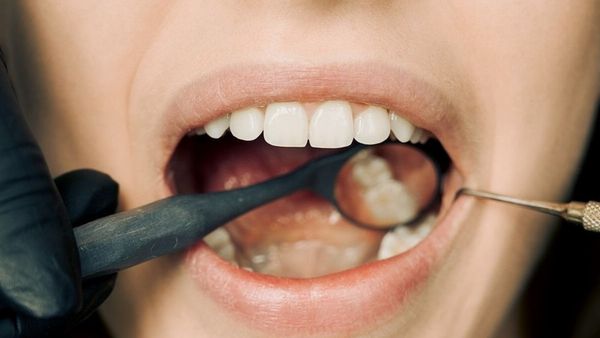 Bleeding gum: ঘন ঘন মাড়ি দিয়ে রক্ত বেরোচ্ছে, মুক্তি মিলবে এই উপায়গুলি থেকেই