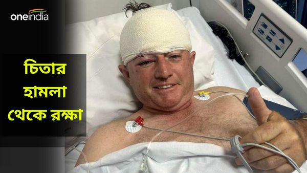 চিতার আক্রমণের মুখে জিম্বাবোয়ের প্রাক্তন ক্রিকেটার, অল্পের জন্য রক্ষা, জরুরি অস্ত্রোপচারের পর স্থিতিশীল