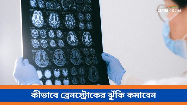 গরমে বাড়ছে ব্রেন স্ট্রোকের ঝুঁকি, কিন্তু কেন, কীভাবে মিলবে রেহাই, জানুন   