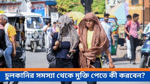  গরমে চুলকানির সমস্যায় অতিষ্ঠ হয়ে উঠেছেন, রেহাই পেতে আজ থেকেই করুন এই প্রতিকারগুলি  