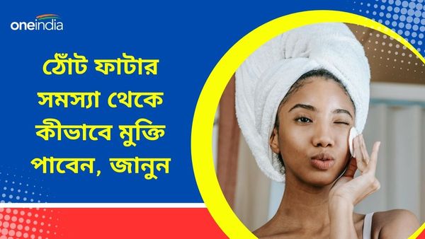 গরমকালেও ফাটছে ঠোঁট, কিন্তু কেন, রেহাই মিলবে এই উপায়েই