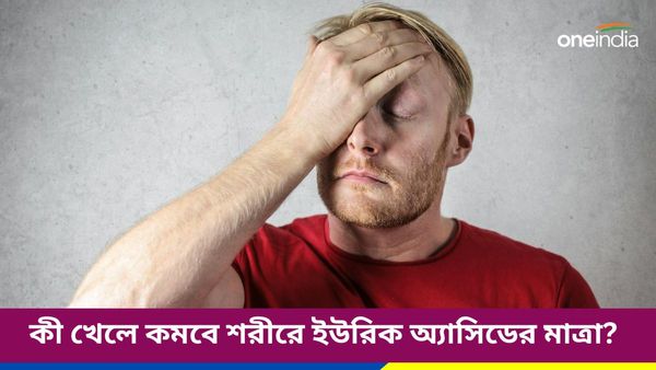 গরমে বাড়ছে শরীরে ইউরিক অ্যাসিডের মাত্রা, নিয়ন্ত্রণে রাখতে কী কী খাবেন