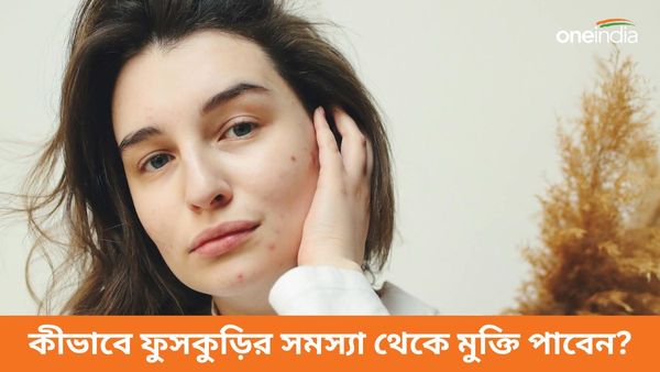 গরমে বাড়ছে ফুসকুড়ির সমস্যা, ট্রেন-বাসে পড়ছেন অস্বস্তিতে, জানুন দ্রুত মুক্তির উপায়