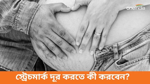 ডেলিভারির পর স্ট্রেচমার্কের সমস্যায় ভুগছেন, দাগ আটকাতে মানুন এই ঘরোয়া প্রতিকারগুলি