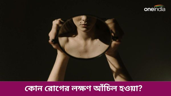 আপনি কি জানেন শরীরে আঁচিল হওয়া মারণ এই রোগের লক্ষণ, আগেই সাবধান হোন