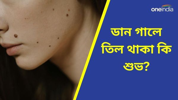 শরীরের কোন কোন অংশে তিল থাকা অত্যন্ত শুভ, জানেন আপনি?
