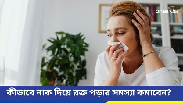 গরমেই বাড়ে নাক দিয়ে রক্ত পড়ার সমস্যা, কিন্তু কেন, জানুন আসল কারণ