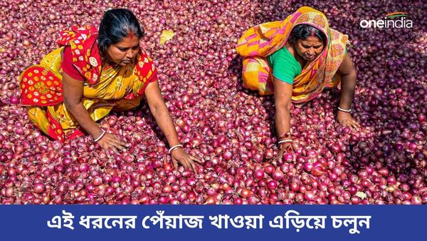 খোসায় কালো দাগ দেখলে ভুলে খাবেন না সেই পেঁয়াজ , কিন্তু কেন, জানুন আসল কারণ