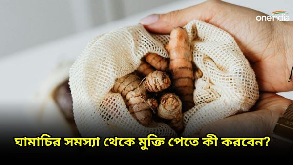 গরমে ঘা, ঘামাচির দাপটে অতিষ্ঠ হয়ে উঠছেন, রেহাই পেতে চুমুক দিন ঘরোয়া এই পানীয়গুলিতে 