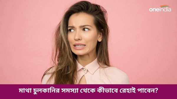 বর্ষায় মাথা চুলকানির সমস্যায় অতিষ্ট হয়ে উঠেছেন, রেহাই মিলবে এই ঘরোয়া উপায়েই 
