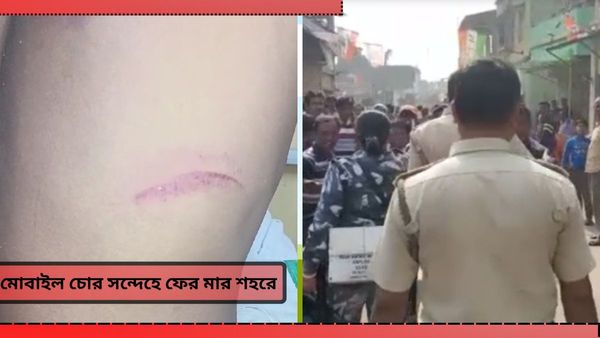 বউবাজার-সল্টলেকের পুনরাবৃত্তি! মোবাইল চোর সন্দেহে যুবককে বেধড়ক মারধরের অভিযোগ