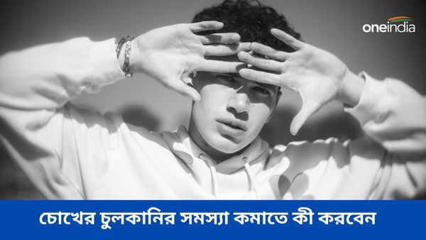 বর্ষায় চোখ চুলকে লাল হচ্ছে, কীভাবে হবেন সতর্ক, জানুন প্রতিকার