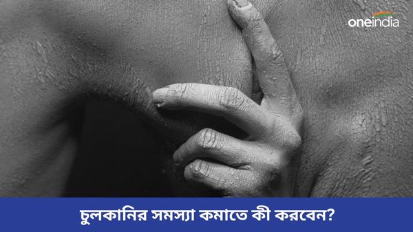 বৃষ্টির জল গায়ে লাগলেই বেরোচ্ছে র‍্যাশ, হচ্ছে চুলকানিও, মুক্তির উপায় বলবে এই ঘরোয়া প্রতিকারই