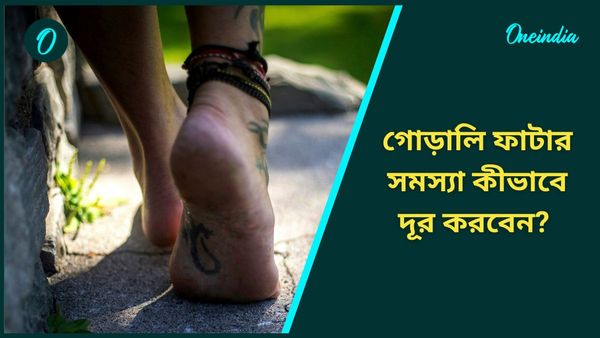 আলতা পরার পরেই গোড়ালি ফাটে আপনারও? দ্রুত সমস্যা থেকে বের হতে মানুন এই ঘরোয়া টিপসগুলি 