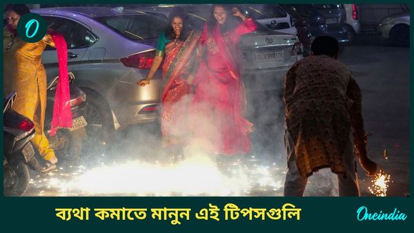 দীপাবলিতে আতস বাজি ফাটাতে গিয়ে হাত পুড়ে গেলে দ্রুত ব্যথা কমাতে মানুন এই টিপসগুলি  