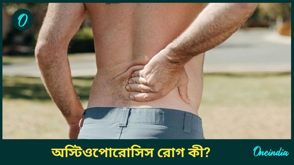 অস্টিওপোরোসিস কী, কাদের এই রোগের ঝুঁকি বেশি, কীভাবে ঝুঁকি এড়াবেন 