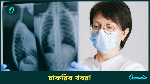 সরকারি হাসপাতালে চিকিৎসক পদে ব্যাপক নিয়োগ,  UPSC-এর মাধ্যমে নিয়োগ 