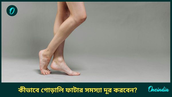 শীতে পায়ের গোড়ালি ফাটার সমস্যায় ভুগছেন? মুক্তি উপায় বলবে এই টিপসগুলি 