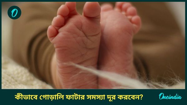 শীতে গোড়ালি ফেটে চৌচির, ঘরোয়া এই উপায়গুলিতেই মিলবে সমাধান  