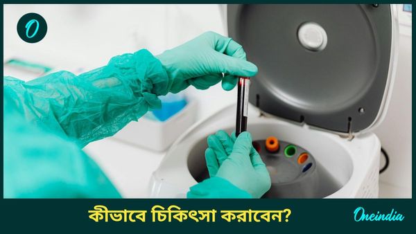 Human Metapneumovirus-এ আক্রান্ত হলে কী চিকিৎসা করা হবে? কীভাবেই বা নিজেকে বাঁচাবেন?