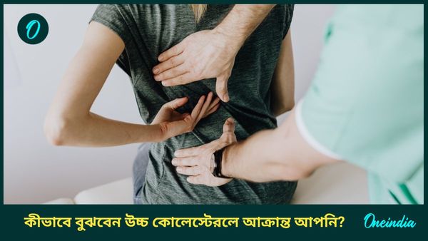 শরীরে কোলেস্টেরলের মাত্রা বাড়লে বুঝবেন কীভাবে, জানুন লক্ষণ