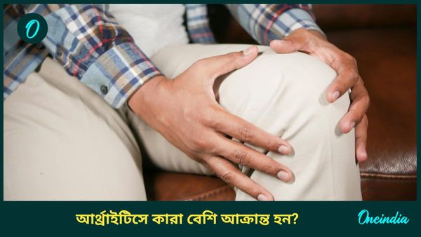 আপনি কি আর্থ্রাইটিসে আক্রান্ত, ইউরিক অ্যাসিডও বেশি? জানুন লক্ষণ, কীভাবে সতর্ক থাকবেন  