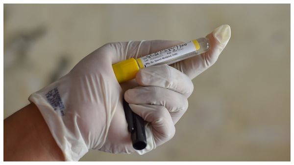 রক্ত পরীক্ষায় ক্যানসারের আগাম বার্তা! উপসর্গের ১০ বছর আগেই মাথা ও ঘাড়ের ক্যানসার শনাক্তে নতুন বিপ্লব