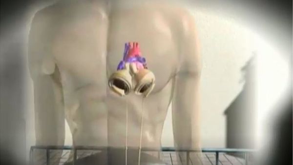 নিজের হৃদপিণ্ড ব্যাগে নিয়ে ঘুরে বেড়ান যে নারী