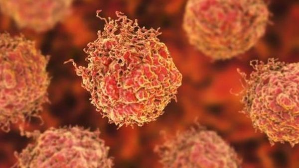 যে কারণে অতিরিক্ত ওজন ক্যান্সার ঝুঁকি তৈরি করতে পারে