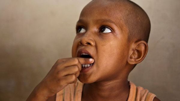 যক্ষ্মা: শিশুদের জন্য নীরব ঘাতক রোগটি শনাক্তে যে কারণে সমস্যা হয়