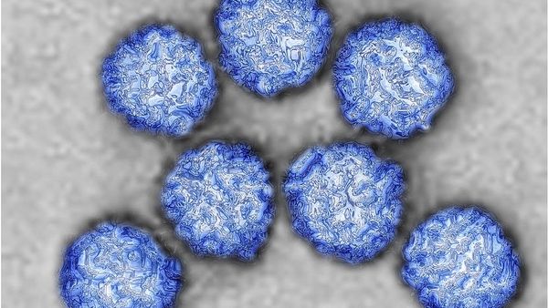 টমেটো ফ্লু: ভারতে শতাধিক আক্রান্ত, কীভাবে ছড়ায় এই রোগ?