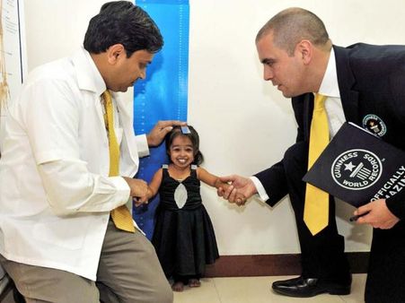 એકોન્ડ્રોપ્લેસિયાથી પીડાય છે એકોન્ડ્રોપ્લેસિયાથી પીડાય છે