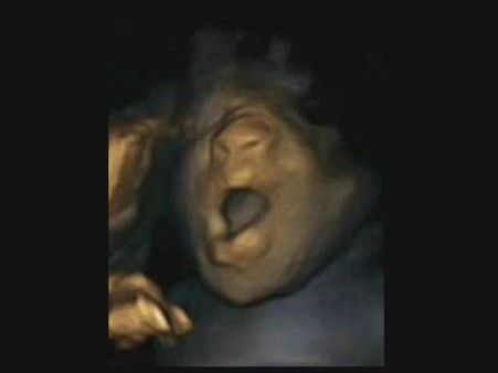 માના ગર્ભમાં આ રીતે વિકસે છે બાળક