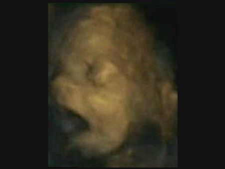 માના ગર્ભમાં આ રીતે વિકસે છે બાળક