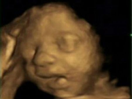 માના ગર્ભમાં એક પિંડ આ રીતે ફેરવાય છે ચહેરામાં