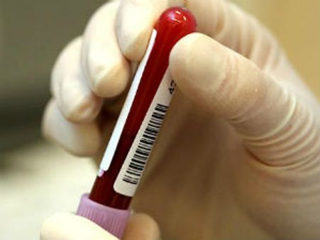 વૈજ્ઞાનિકોએ શોધી એઇડ્સની સારવાર