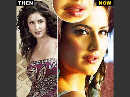 Pics : સર્જરી દ્વારા સૌંદર્ય પામતી બૉલીવુડ સુંદરીઓ