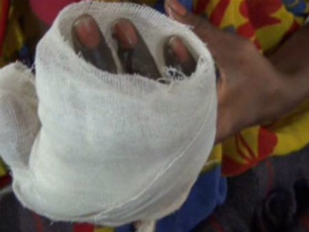 ગુજરાત: સાસુ-સસરાએ લીધી પુત્રવધુની 'અગ્નિપરિક્ષા'