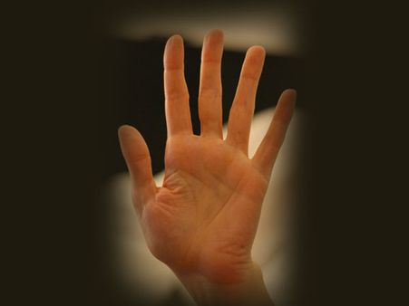 ડાબી હથેલી પર તલ