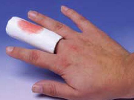 ઇજા પહોંચવી